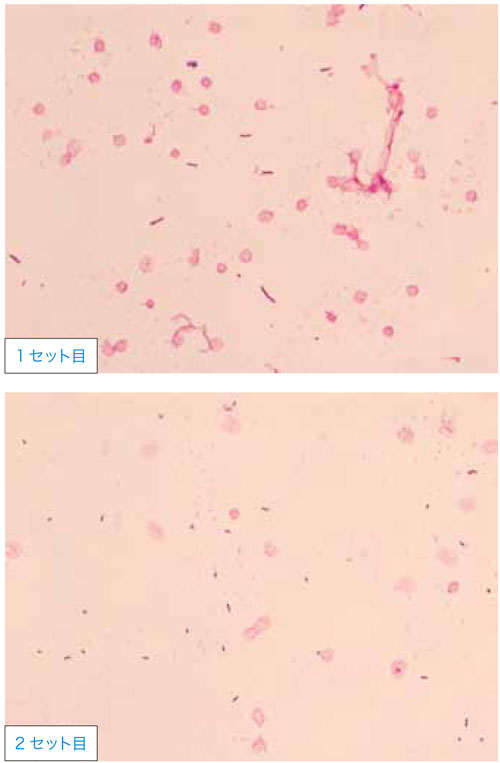 グラム染色道場2 – 日本医事新報社